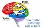 Cerebralno o&scaron;tećenje vida u djece - obavijest o tečaju